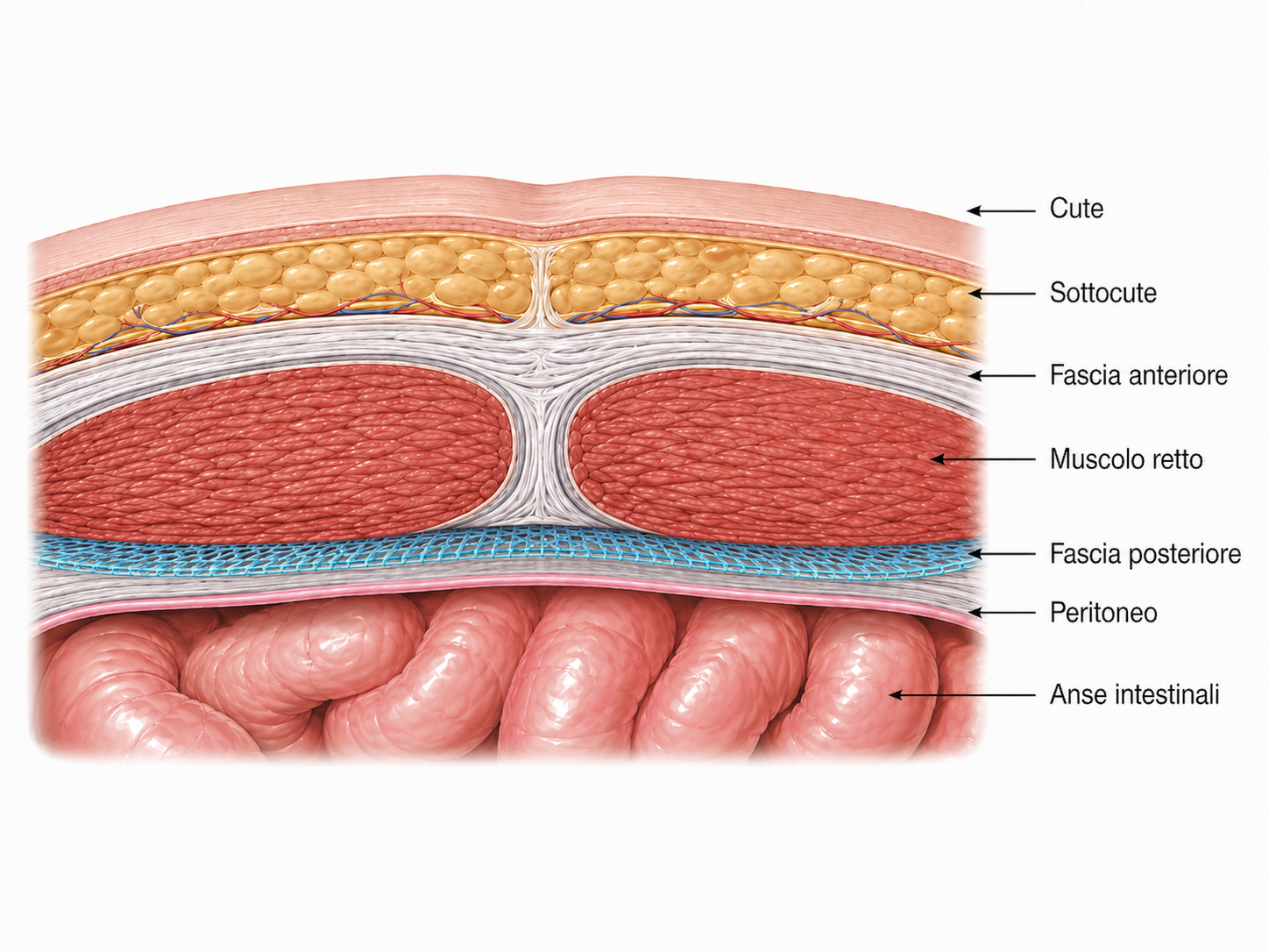 Schema anatomico del posizionamento della protesi retromuscolare tra fascia posteriore e muscolo retto