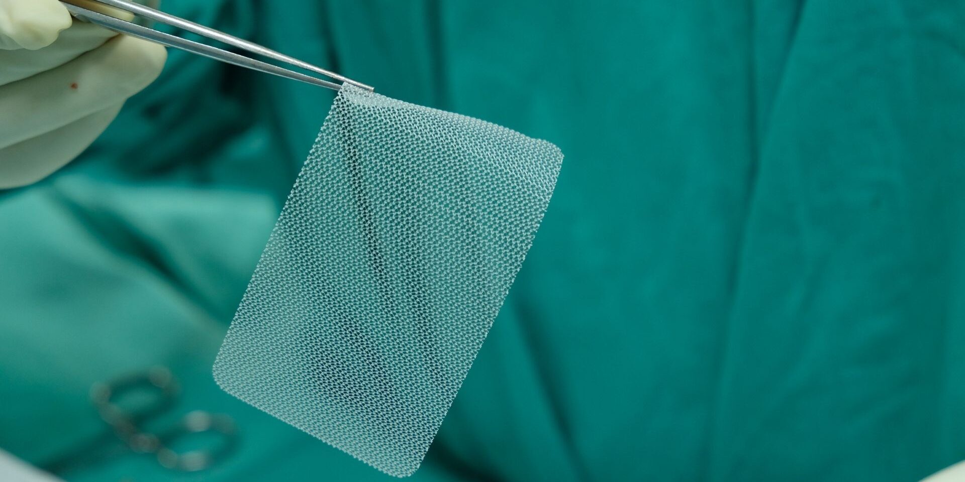 Rete protesica utilizzata nella riparazione dell'ernia ombelicale